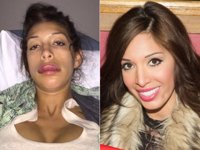 farrah abraham plastic surgery gone wrong 