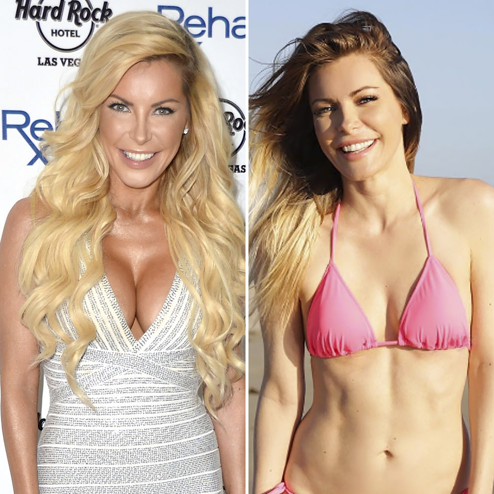Celebrities Who Removed Their Breast Implants— Before And