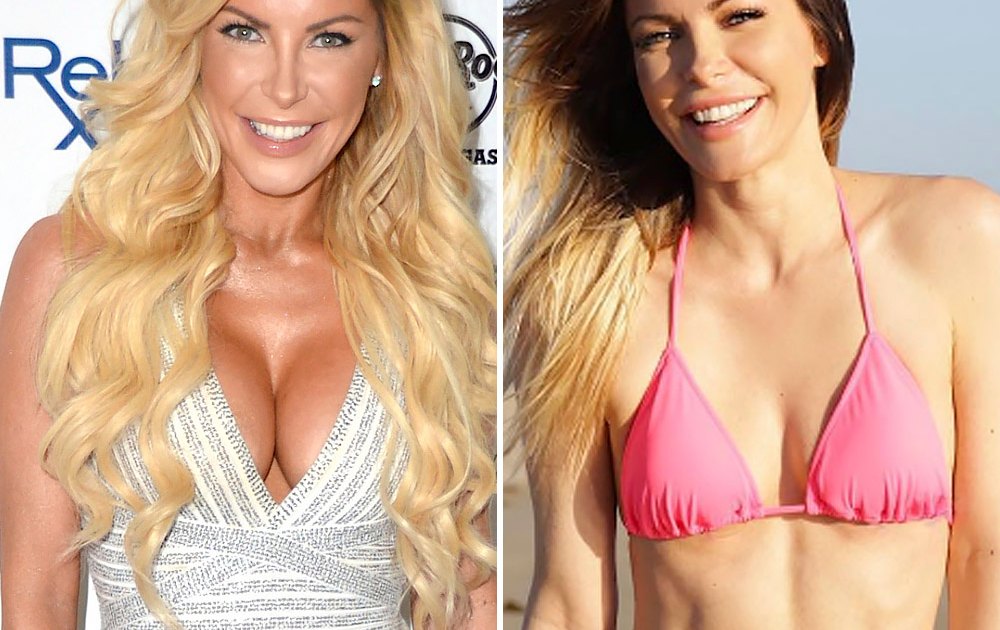 Celebrities Who Removed Their Breast Implants— Before-and-After Pics