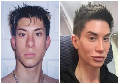 justin jedlica before and after