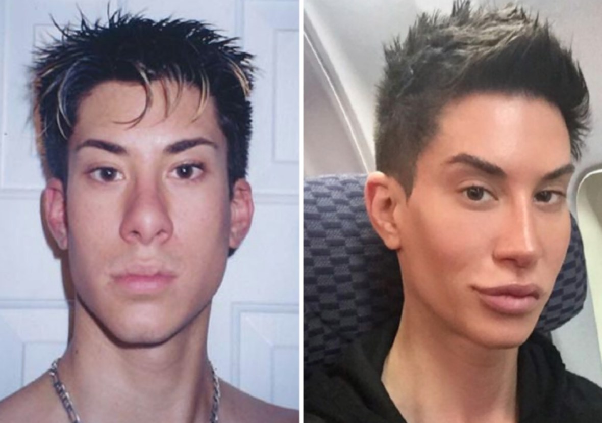 See What "Human Ken Doll" Justin Jedlica Looked Like