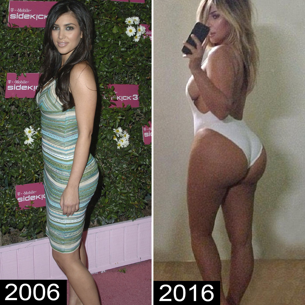 See Which Celebrities Are Rumored To Have Gotten Butt Implants