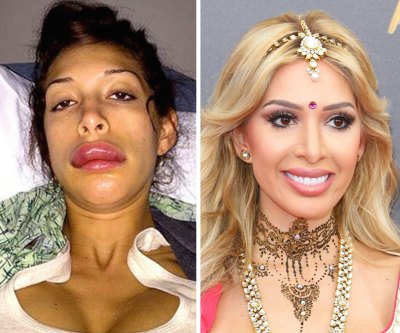 farrah abraham lips before and after