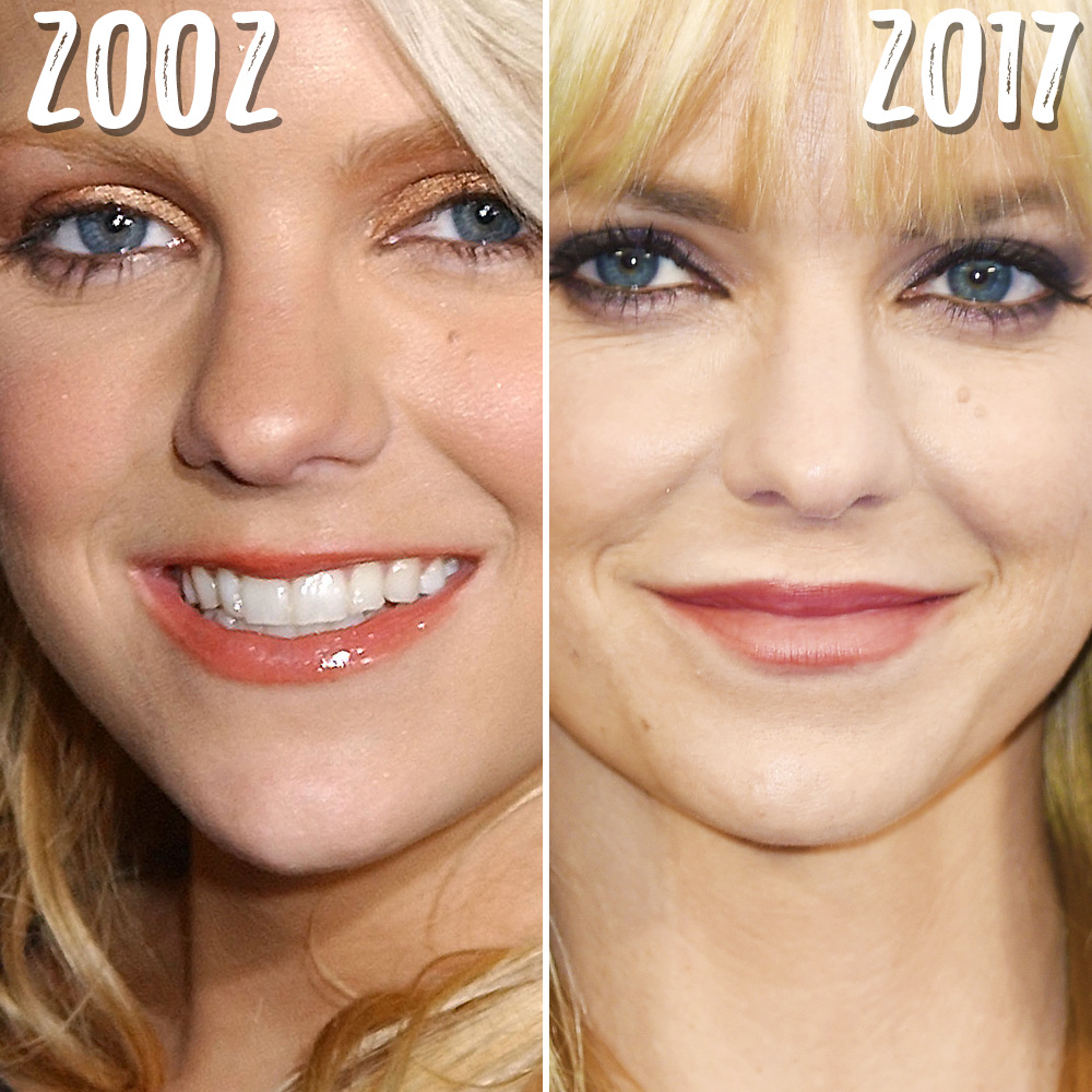 800px x 800px - Anna Faris: Breast Implants and a Makeover Have Transformed Her Look