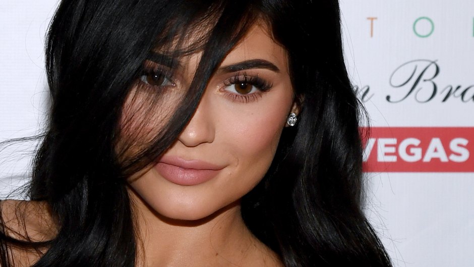 Kylie jenner pregnant lip injections