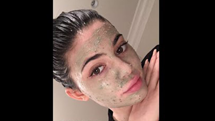 Kylie jenner acne