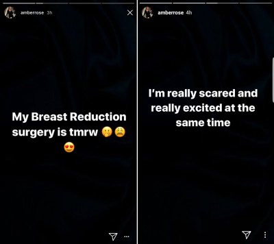 amber rose breast reduction, instagram