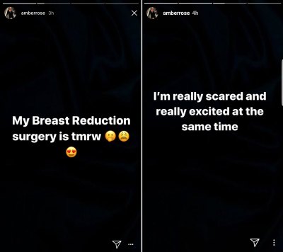 Amber Rose Is Getting a Breast Reduction, Since They're Stupid Heavy