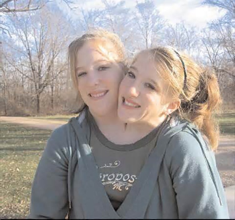 Abby and Brittany Hensel — See What the Famous Conjoined Twins Look