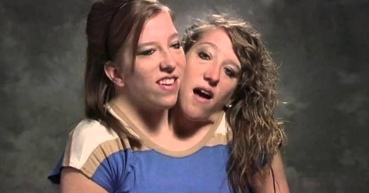 Contained In The Quiet Lives Of Conjoined Twins Abby And Brittany Hensel Right This Moment Hardki
