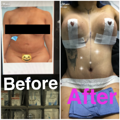 https://www.intouchweekly.com/wp-content/uploads/2018/04/briana-dejesus-before-after.png?fit=400%2C400&quality=86&strip=all&resize=400%2C400