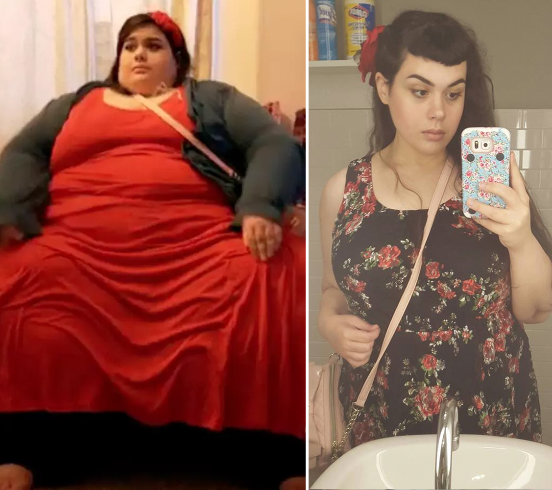 'My 600lb Life' Before and After Photos — Where Are They Now?