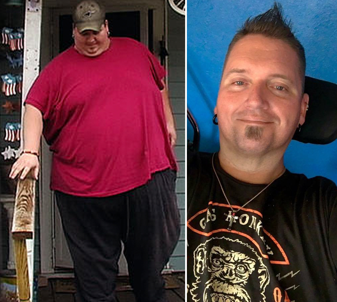 50 A fogyás előtt és után olyan képek, amelyek meglepő módon ugyanazt a személyt mutatják