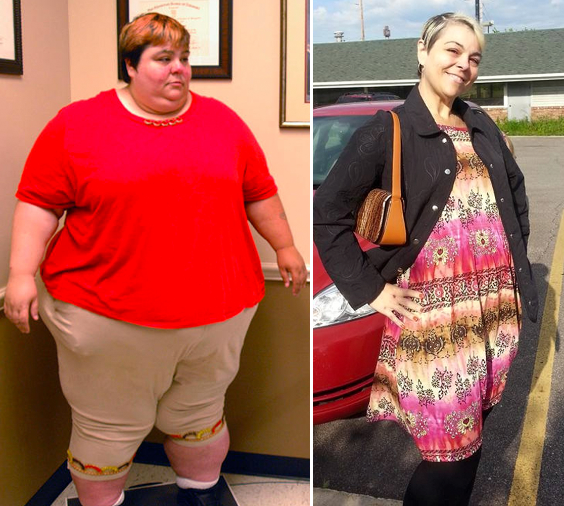 'My 600Lb Life' Before and After Photos — Where Are They Now?