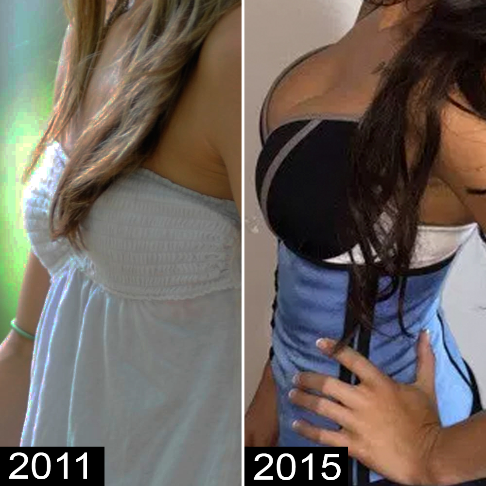 Jenelle Evans Plastic Surgery — See Before and After Pics