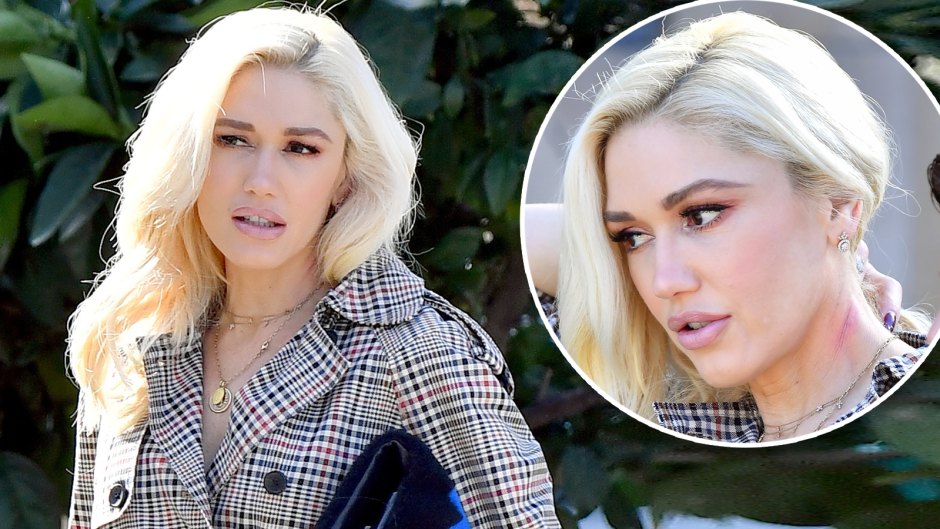 gwen stefani steps out with mysterious mark on her neck