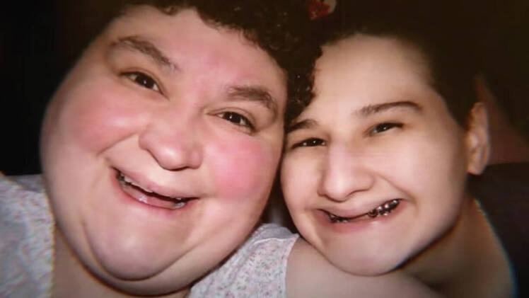 Gypsy Rose Blanchard Teeth