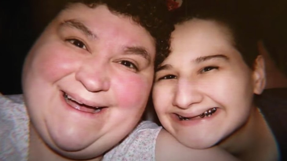 What Happened to Gypsy Rose Blanchard's Teeth