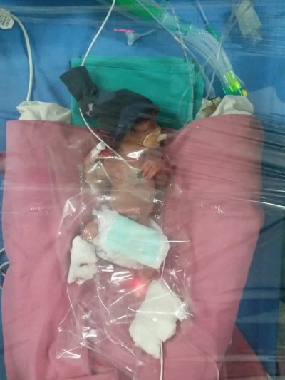 Premature Baby in Hospital