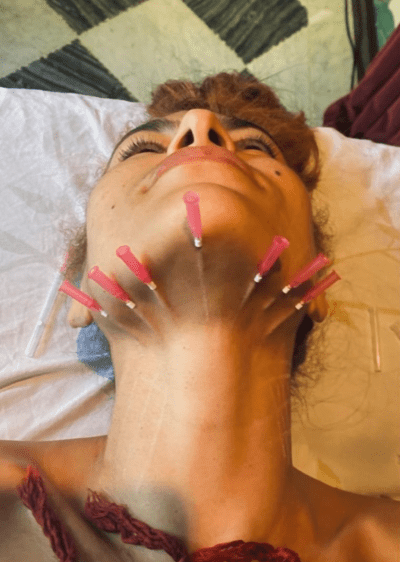 Eva Mendes Reveals Cosmetic Procedure Mono-Threading