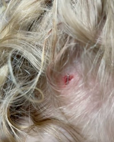 Riley Busby Gets Staple In Her Head Amid Mom Danielle's Health Scare