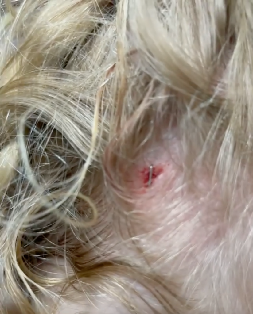 Riley Busby Gets Staple In Her Head Amid Mom Danielle's Health Scare