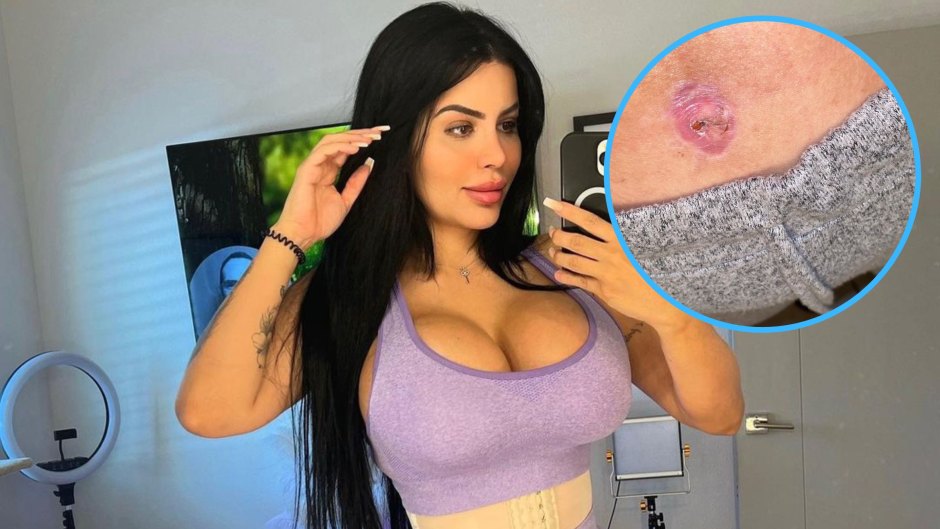 Woman reveals she has 4 implants in her breasts on 'Botched