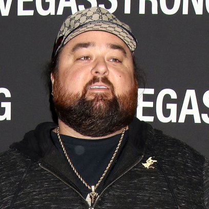 Pawn Stars Chumlee Reveals 160-Pound Weight Loss After Gastric Surgery