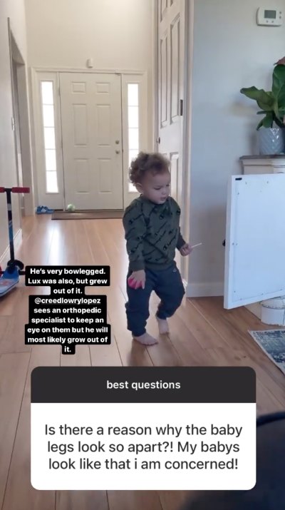 Kailyn Lowry's son Creed bowlegged.