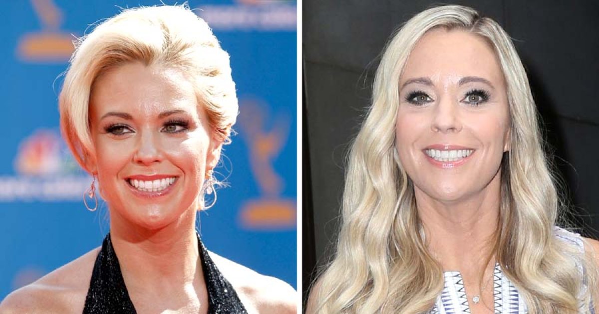 sum licens Shah Kate Gosselin Plastic Surgery: What Procedures She's Had Done