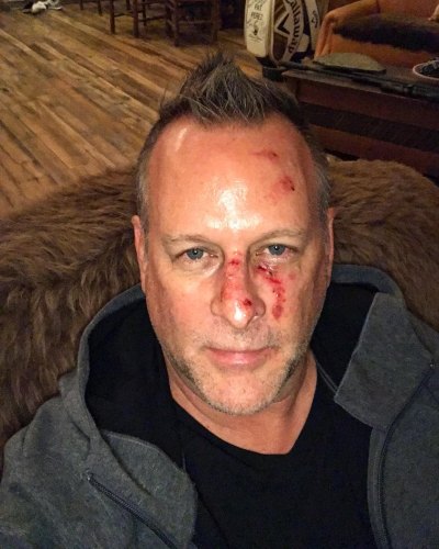 Dave Coulier Shares Graphic Photo for Sobriety Message: ‘I Was a Drunk’  