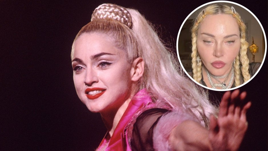 horsepower Cook a meal Round Madonna Transformation: Photos Amid Plastic Surgery Rumors