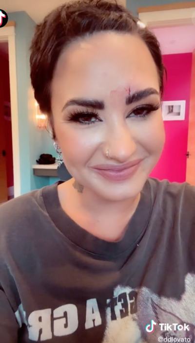 Demi Lovato Reveals They Need Stitches After Brutal Facial Injury Caused by a Crystal