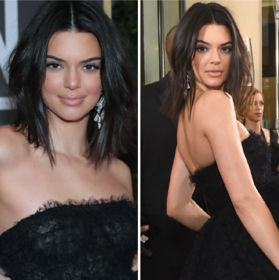 Kendall Jenner Has Long Been the Subject of Plastic Surgery Rumors — But Has She Gone Under the Knife?