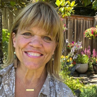 Little People Big World Amy Roloff Plastic Surgery Quotes