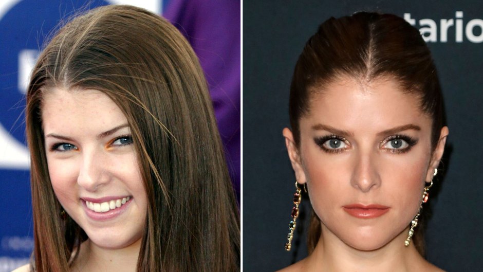 Anna Kendrick Transformation: Photos Then and Now