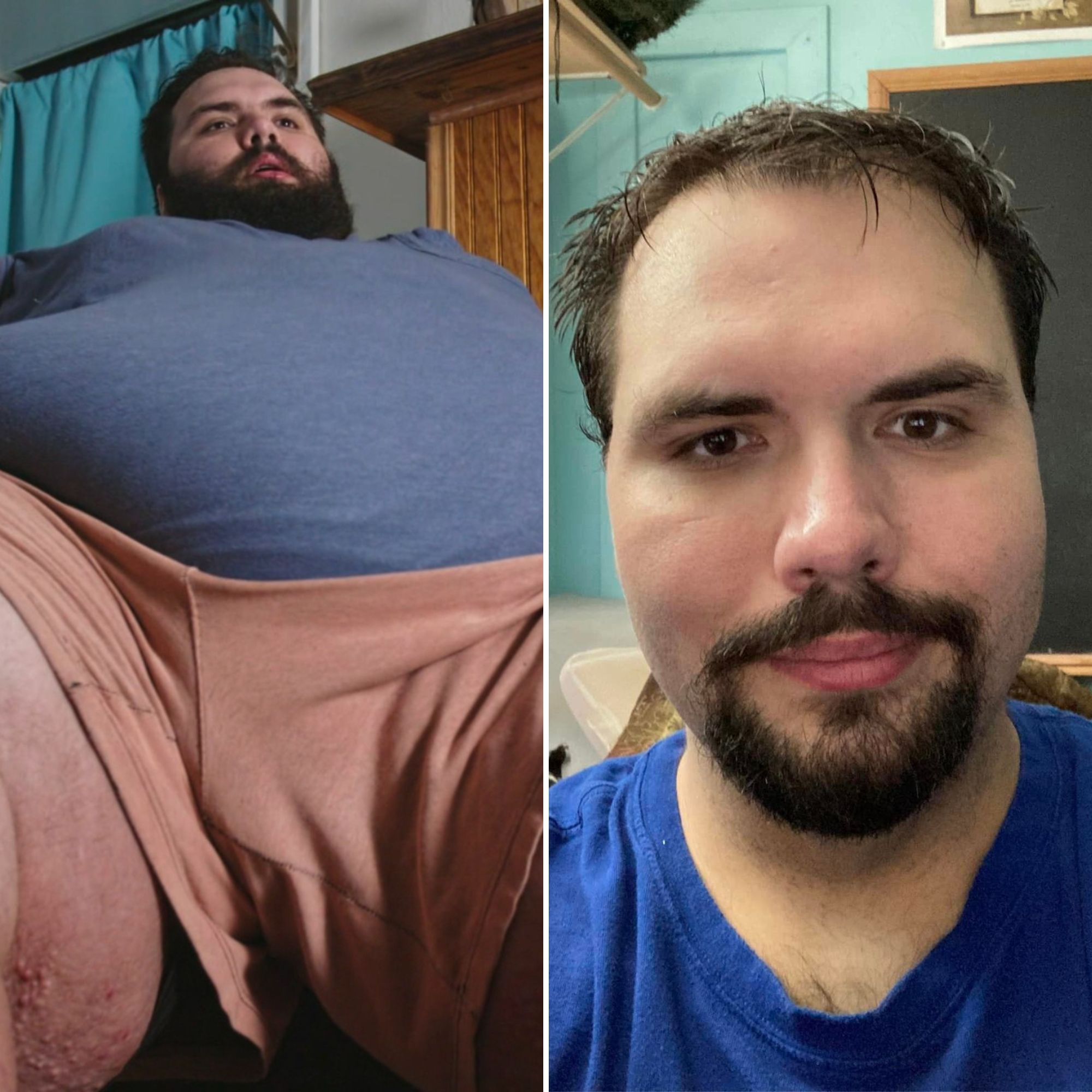 My 600-lb Life': Dr. Nowzaradan Doesn't Want Fans Sliding Into His DMs