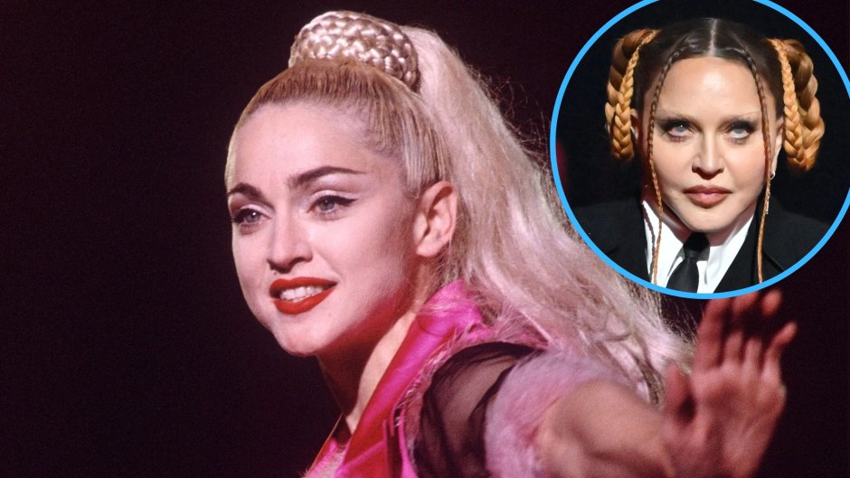 Material Girl! Madonna's Transformation From the '80s to Today Amid Plastic Surgery Rumors