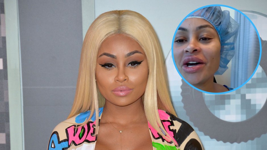 Blac Chyna Undergoes Breast and Butt Reduction as Part of ‘Life Changing Journey’