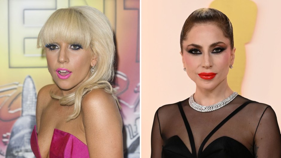 Lady Gaga Transformation: Photos of Her Then and Now