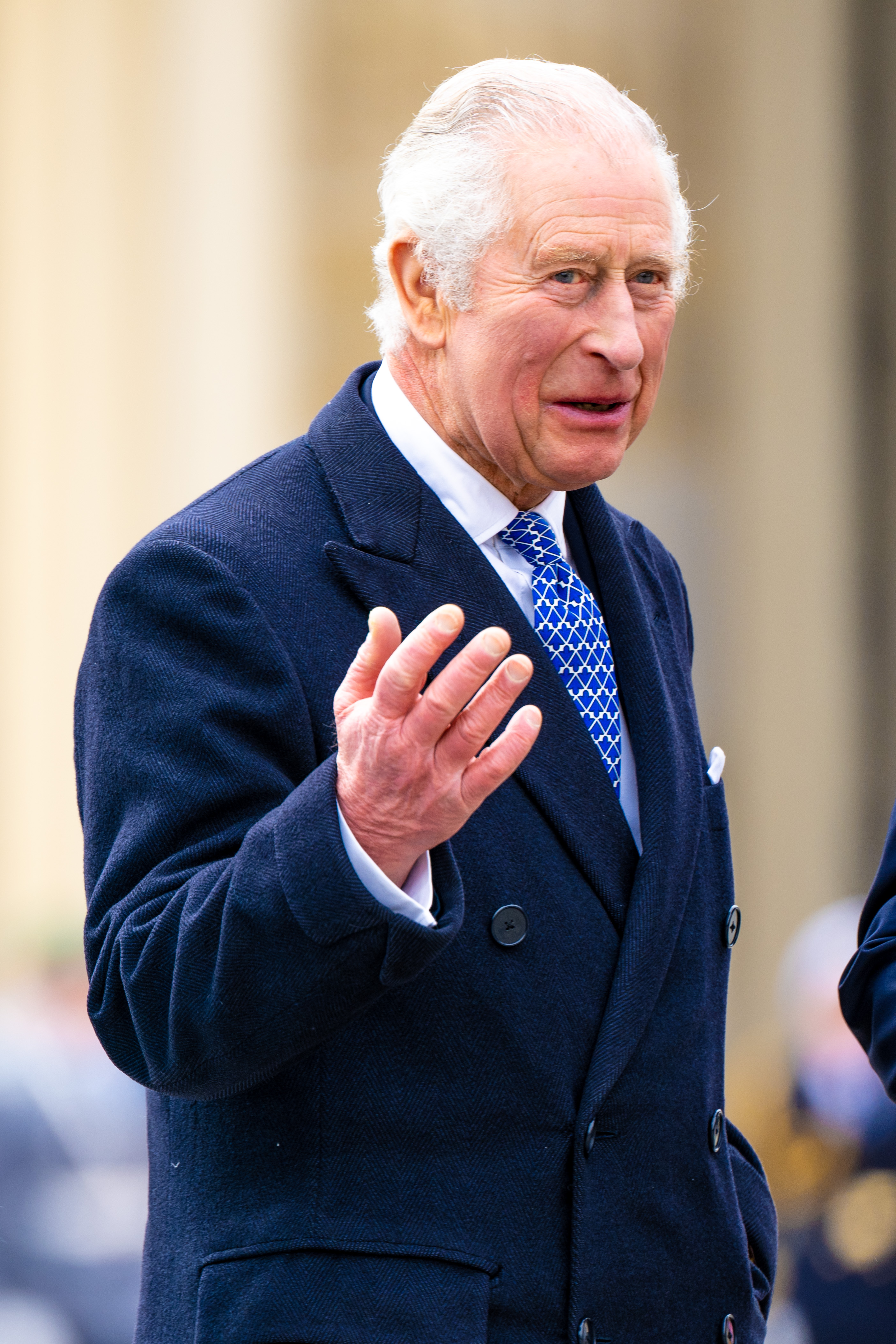 King Charles' Fingers: Photos of His Swollen Hands