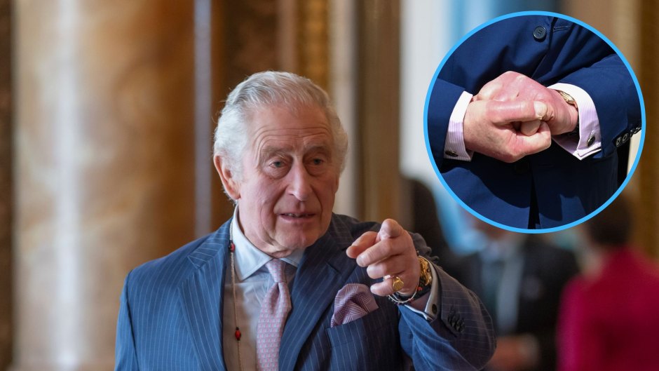 Why Are King Charles’ Fingers Swollen? See Photos of His Fingers Amid Health Concerns