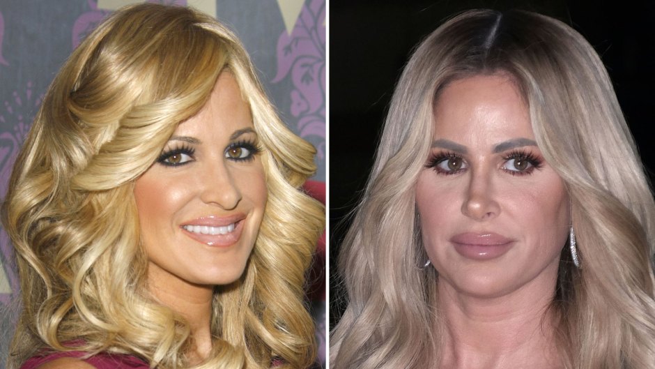 Did RHOA’s Kim Zolciak Ever Get Plastic Surgery? See Photos of Her From Then and Now