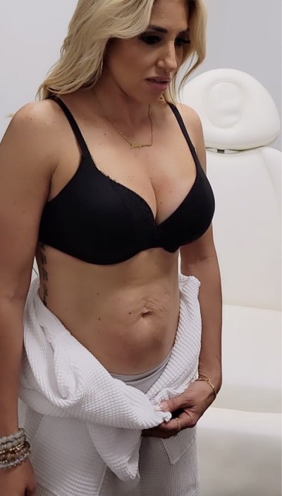 RHONJ's Danielle Cabral ​Undergoes Tummy Tuck After Being ‘Tortured’ by Her Appearance ‘For Years’