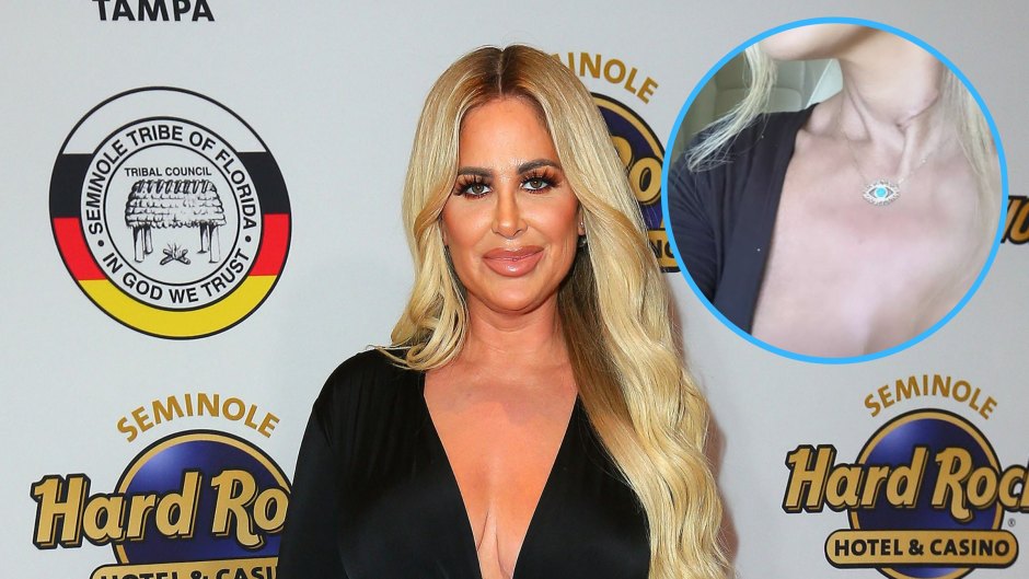 Kim Zolciak Shows Off Neck Scar After She Underwent Surgery for Herniated Disc: ‘Looks Amazing’