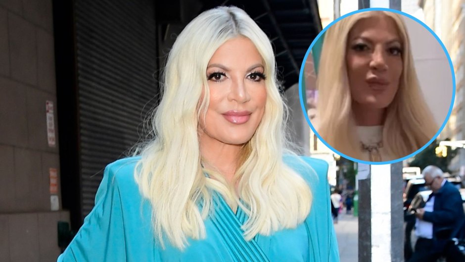 tori spelling face fillers financial woes