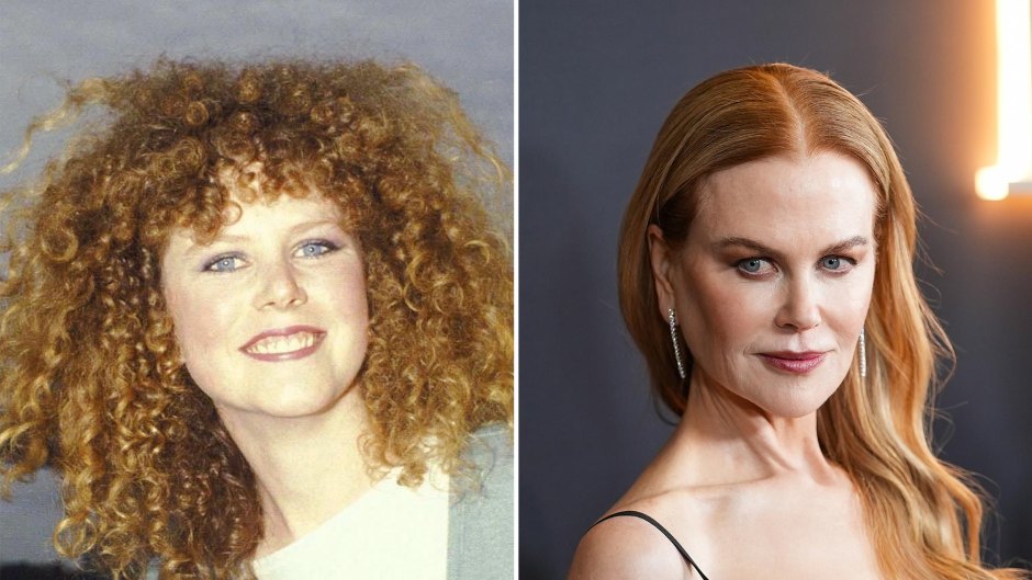 Has Nicole Kidman Had Plastic Surgery See Transformation Photos 094