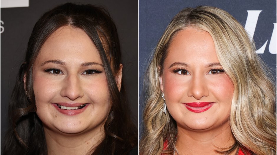 Gypsy Rose Blanchard Nose Job: Before and After Photos